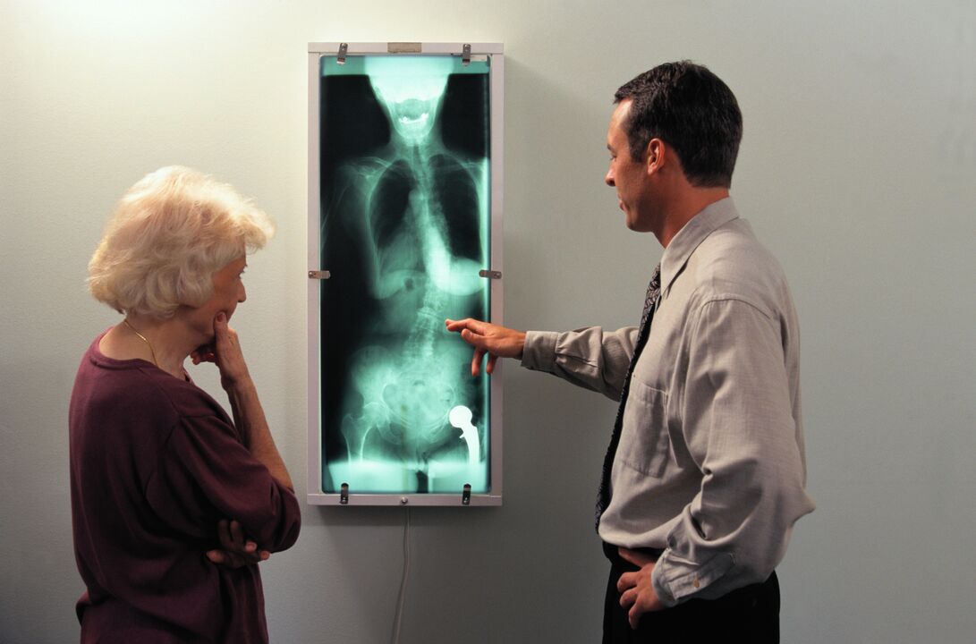 жамбас буынындағы ауырсынуды рентгендік диагностикалау